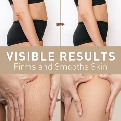 Belly Firming Cream: B Flat Skin Tightening Cream , Cellulite & Stretch Mark Reduction & Tummy Hips Cream & Body Firming for Stomach & Thighs & Arms – 3.38 Fl Oz